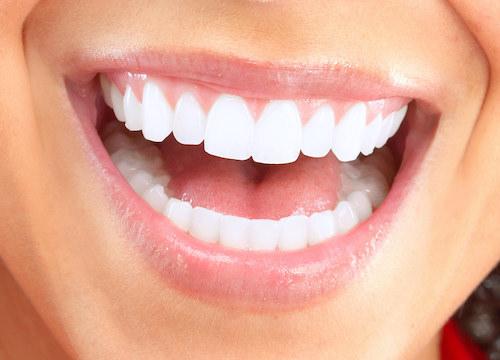Close up of patient's smile at gum disease dentist in Brandon, FL