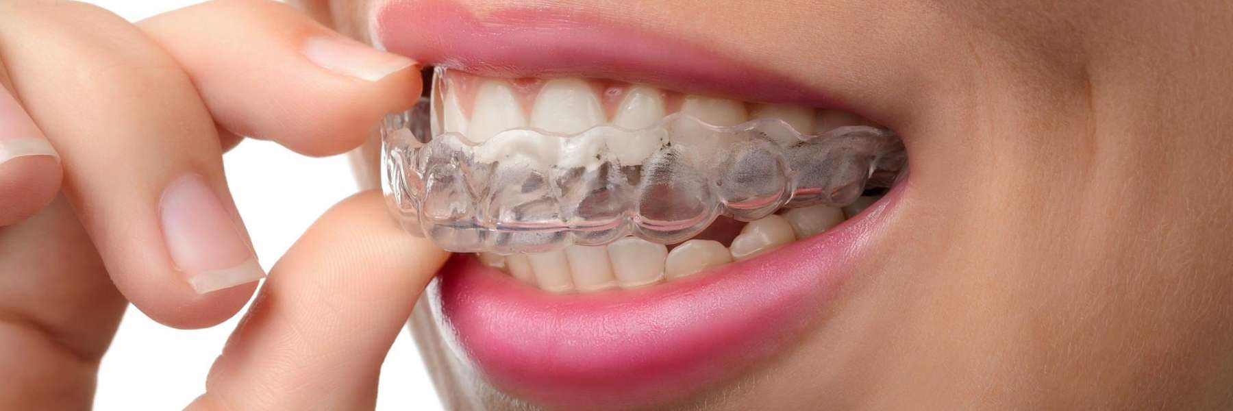 A smiling woman putting in her Invisalign tray | dentist Brandon, FL