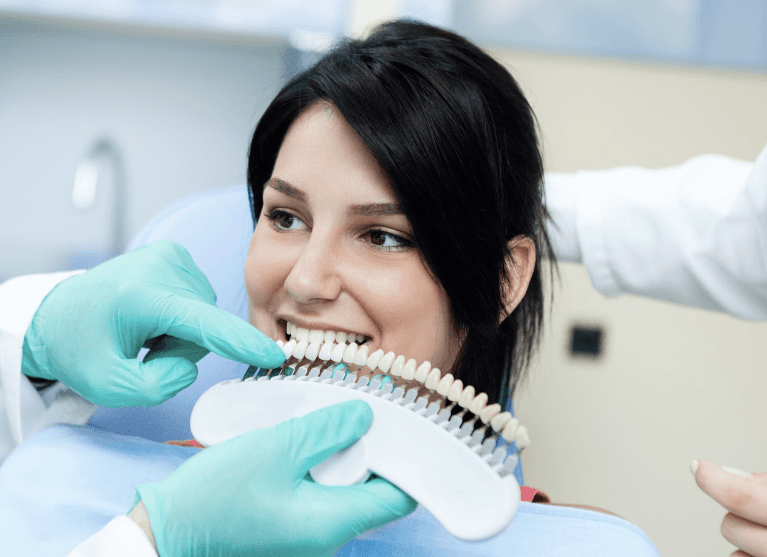 teeth whitening services | dentist Brandon, FL