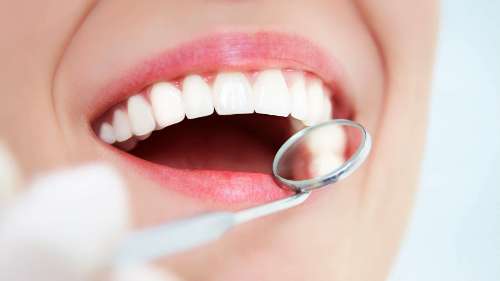 woman getting her teeth cleaned in brandon fl