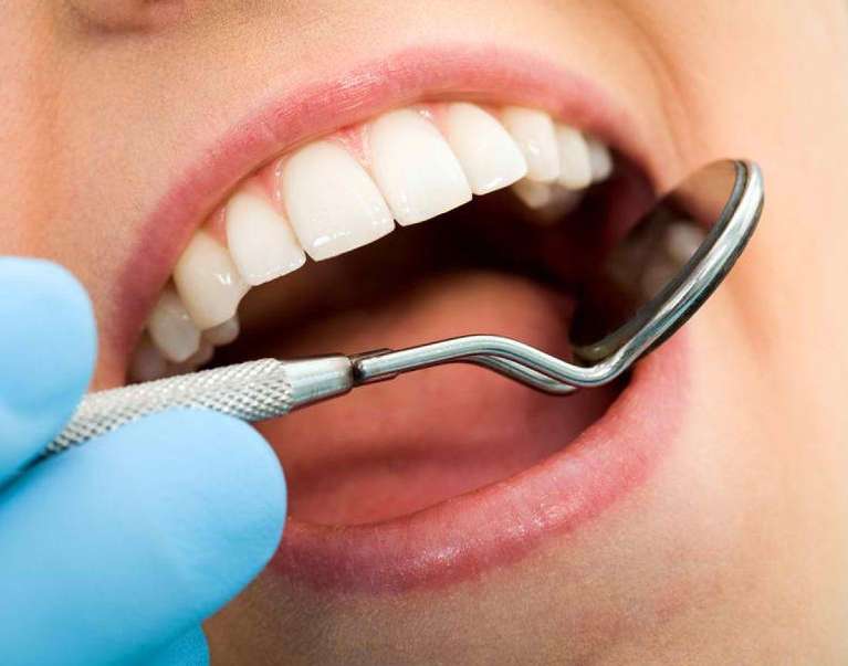 Dentist performing routine dental exam with mirror and scaler at a modern dental office in Brandon, 