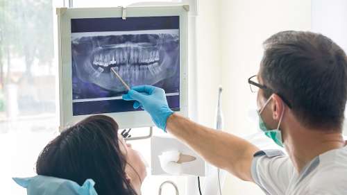 dentist showing his patient x-rays in brandon fl