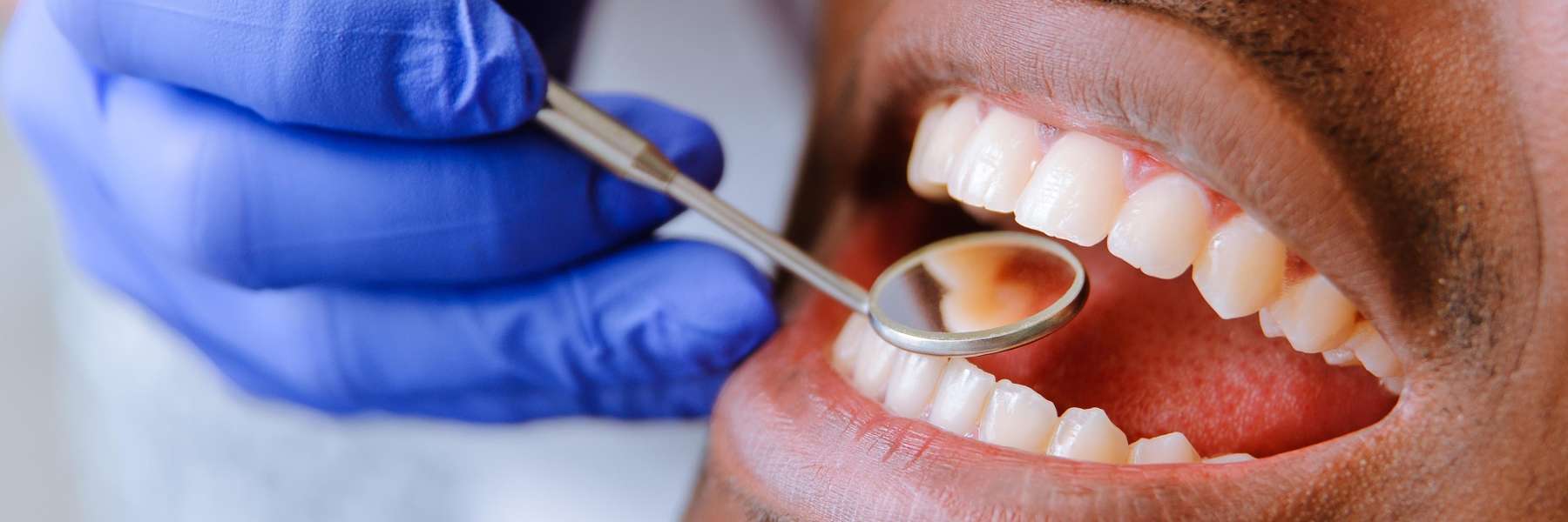 teeth cleaning in brandon fl