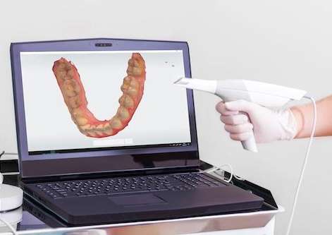 Laptop showing Carestream 3600® Digital Impressions at Brandon, FL dentist