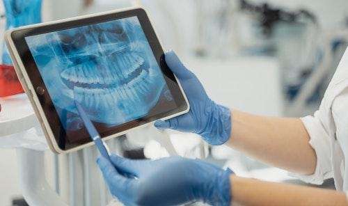 Dentist in Brandon, FL holding tablet with panoramic x-ray scan